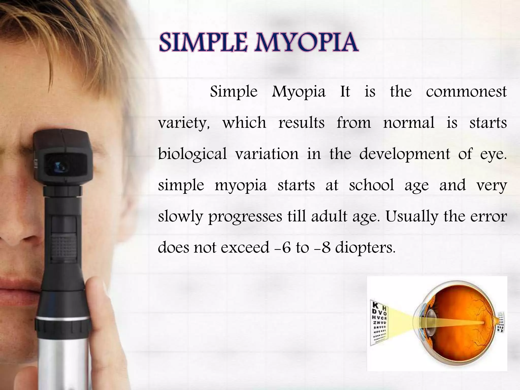Simple Myopia It is the commonest
variety, which results from normal is starts
biological variation in the development of eye.
simple myopia starts at school age and very
slowly progresses till adult age. Usually the error
does not exceed -6 to -8 diopters.
 
