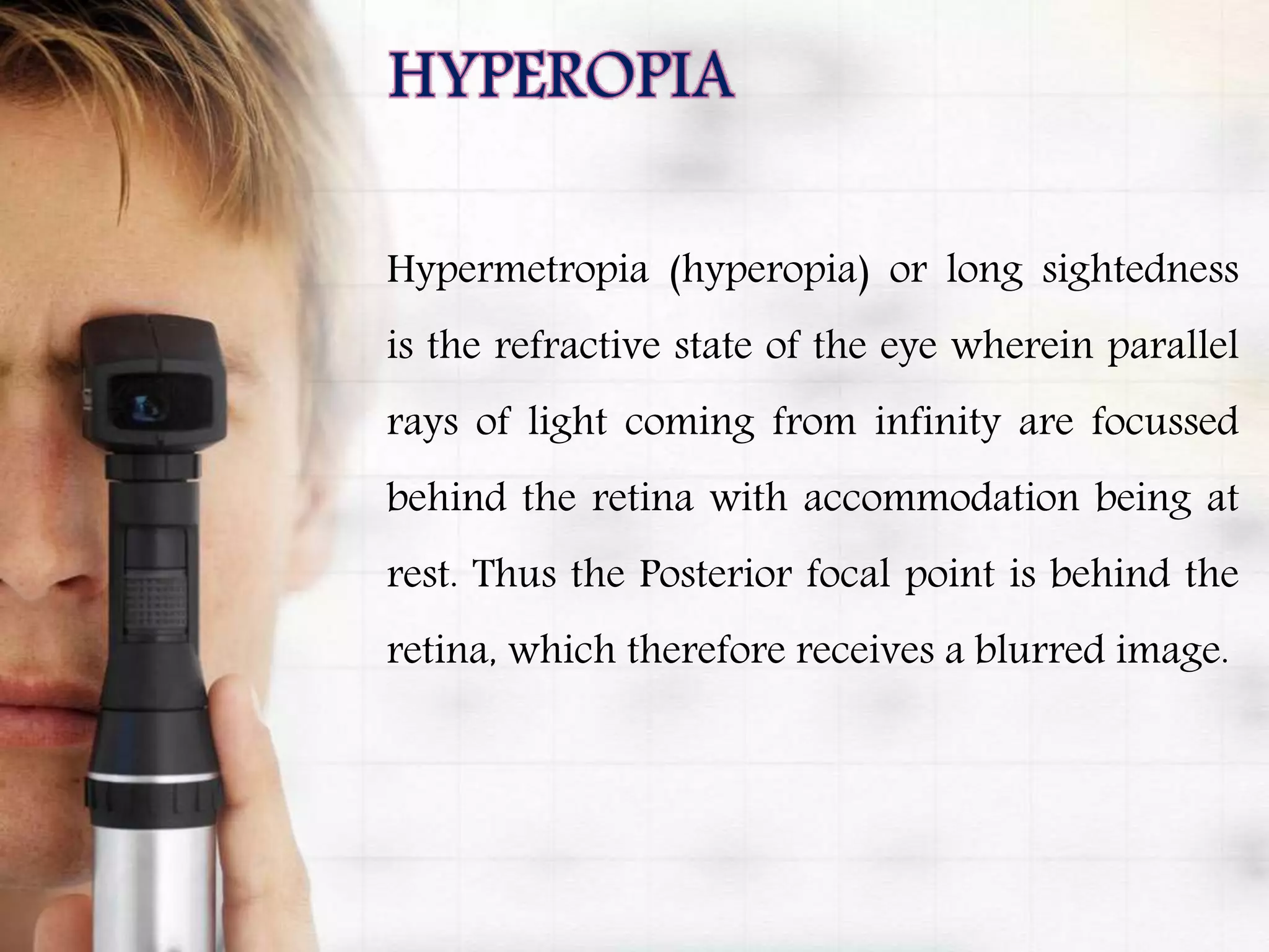Hypermetropia (hyperopia) or long sightedness
is the refractive state of the eye wherein parallel
rays of light coming from infinity are focussed
behind the retina with accommodation being at
rest. Thus the Posterior focal point is behind the
retina, which therefore receives a blurred image.
 