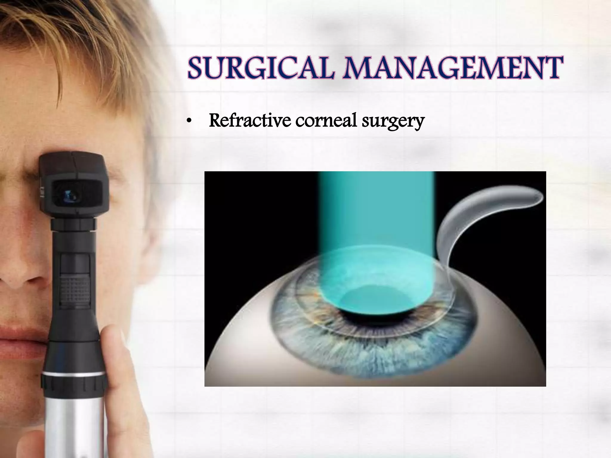 • Refractive corneal surgery
 