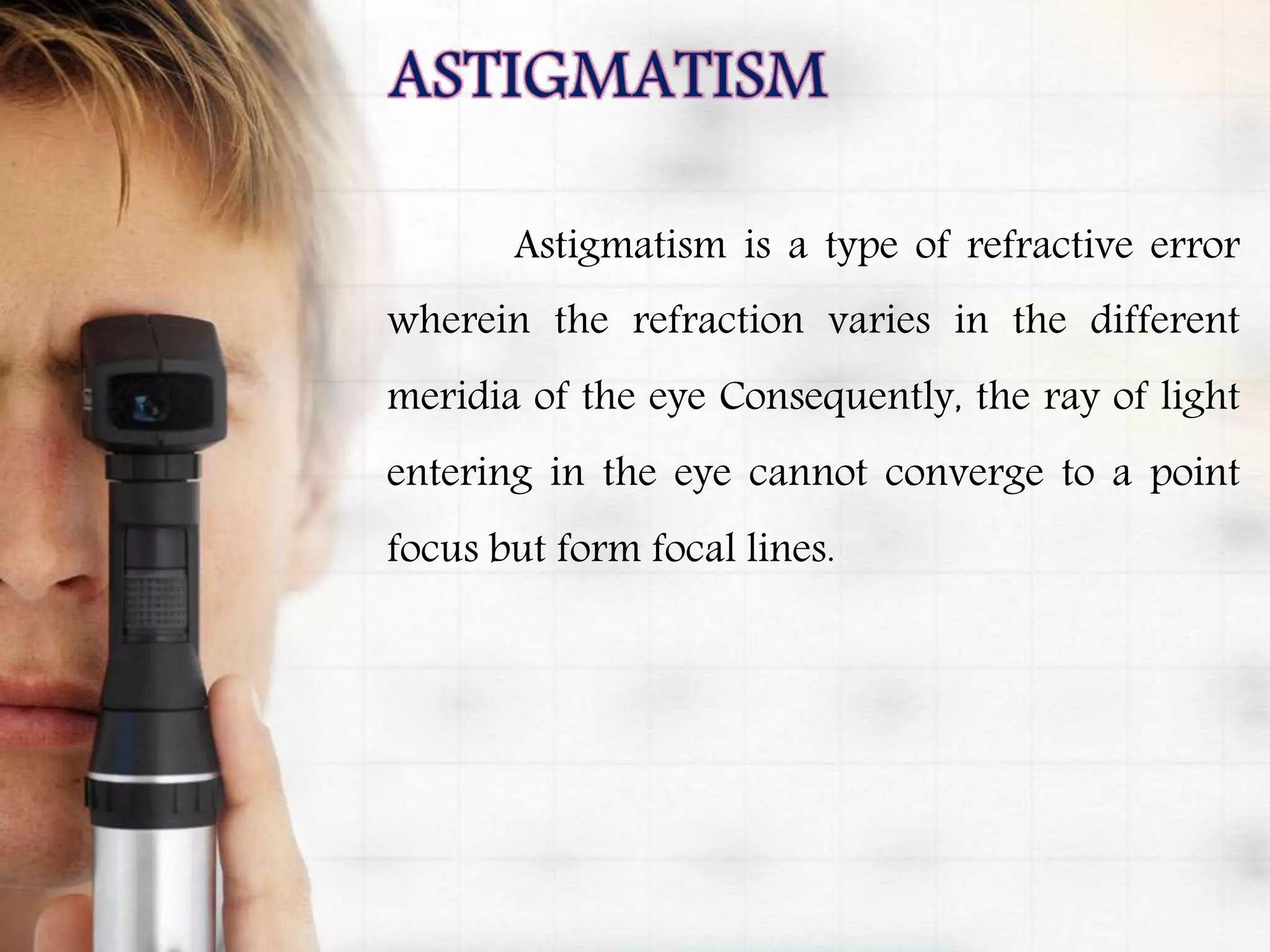 Astigmatism is a type of refractive error
wherein the refraction varies in the different
meridia of the eye Consequently, the ray of light
entering in the eye cannot converge to a point
focus but form focal lines.
 