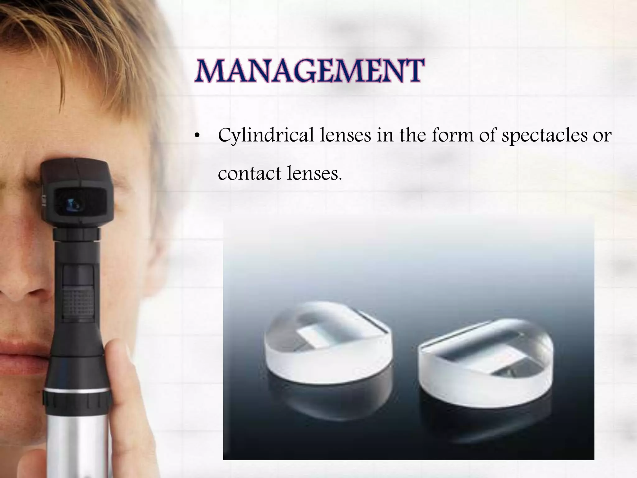• Cylindrical lenses in the form of spectacles or
contact lenses.
 