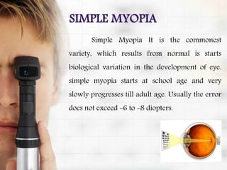 Simple Myopia It is the commonest
variety, which results from normal is starts
biological variation in the development of eye.
simple myopia starts at school age and very
slowly progresses till adult age. Usually the error
does not exceed -6 to -8 diopters.
 