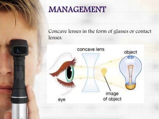 Concave lenses in the form of glasses or contact
lenses.
 