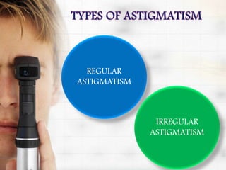 REGULAR
ASTIGMATISM
IRREGULAR
ASTIGMATISM
 