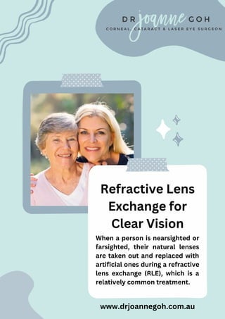 Refractive Lens
Exchange for
Clear Vision
When a person is nearsighted or
farsighted, their natural lenses
are taken out and replaced with
artificial ones during a refractive
lens exchange (RLE), which is a
relatively common treatment.
www.drjoannegoh.com.au
 
