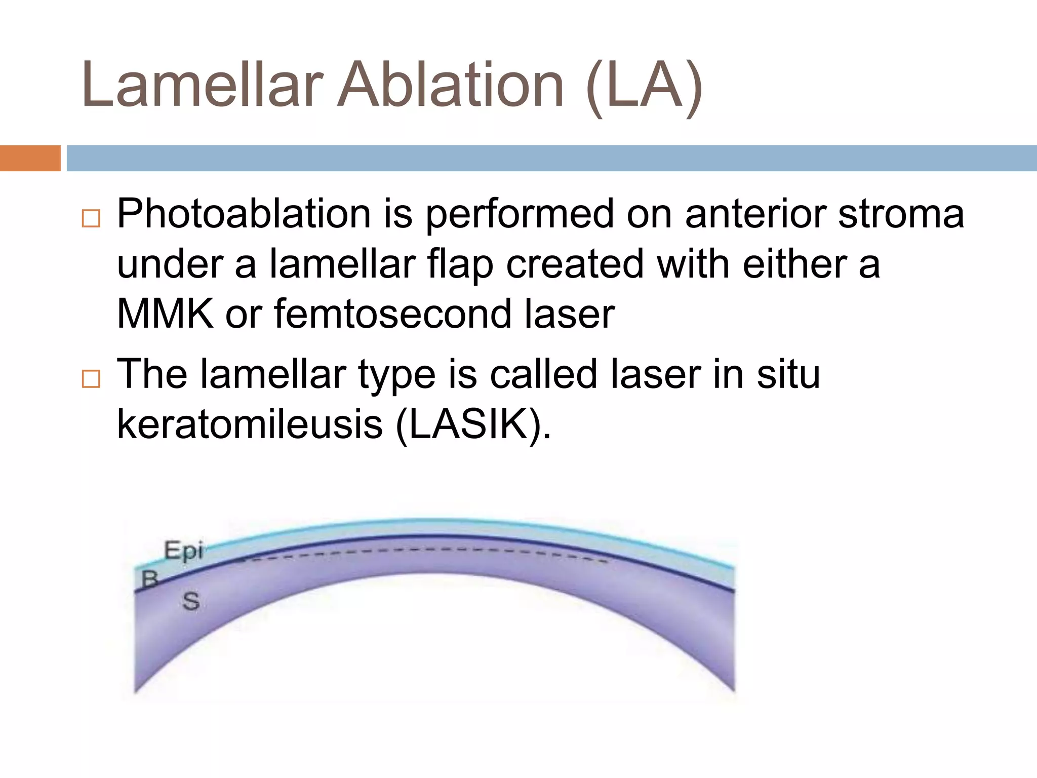 Lamellar Ablation (LA)
 Photoablation is performed on anterior stroma
under a lamellar flap created with either a
MMK or femtosecond laser
 The lamellar type is called laser in situ
keratomileusis (LASIK).
 