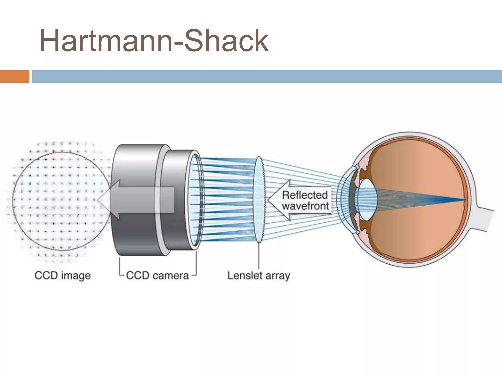 Hartmann-Shack
 
