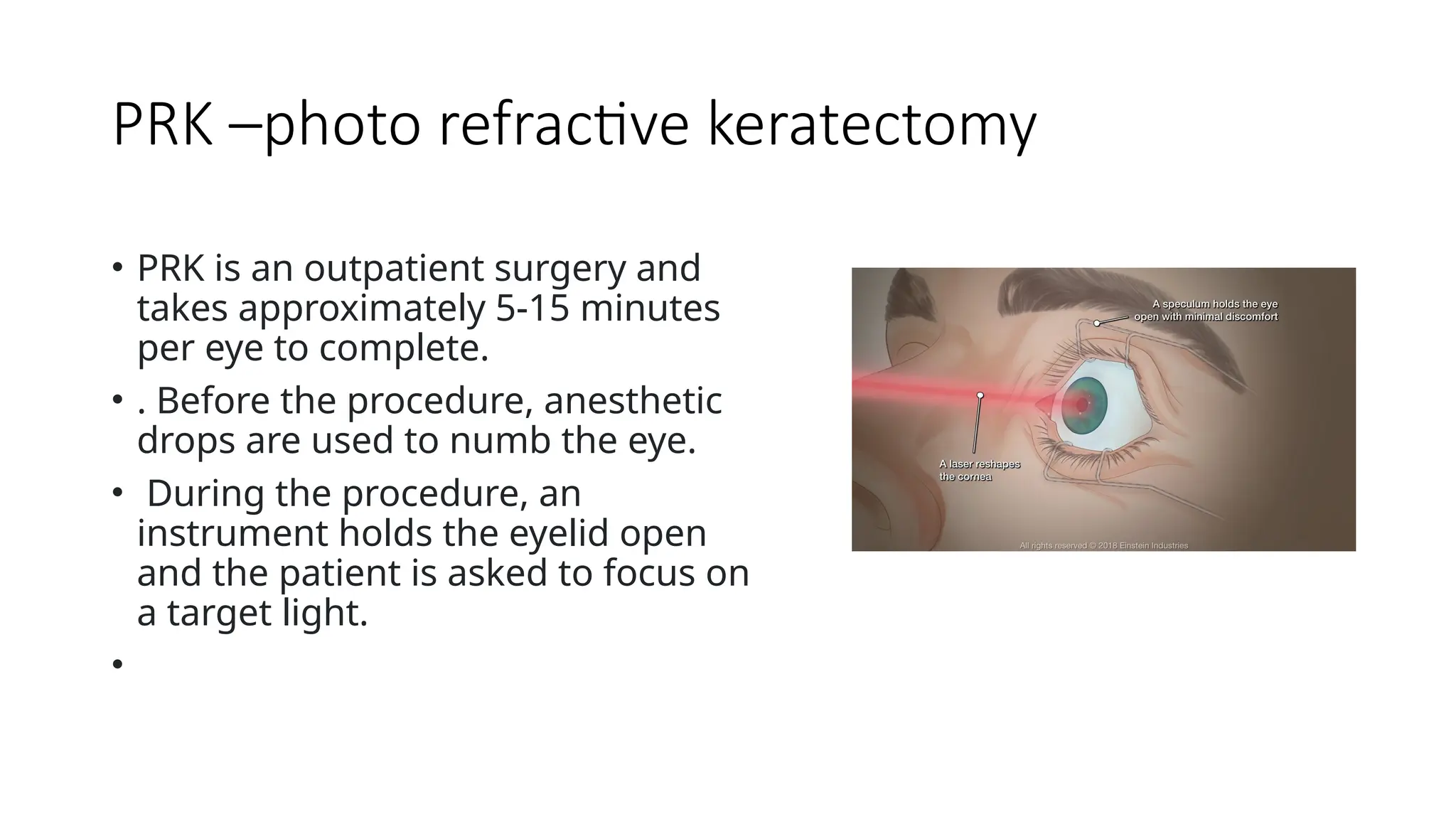 PRK –photo refractive keratectomy
• PRK is an outpatient surgery and
takes approximately 5-15 minutes
per eye to complete.
• . Before the procedure, anesthetic
drops are used to numb the eye.
• During the procedure, an
instrument holds the eyelid open
and the patient is asked to focus on
a target light.
•
 
