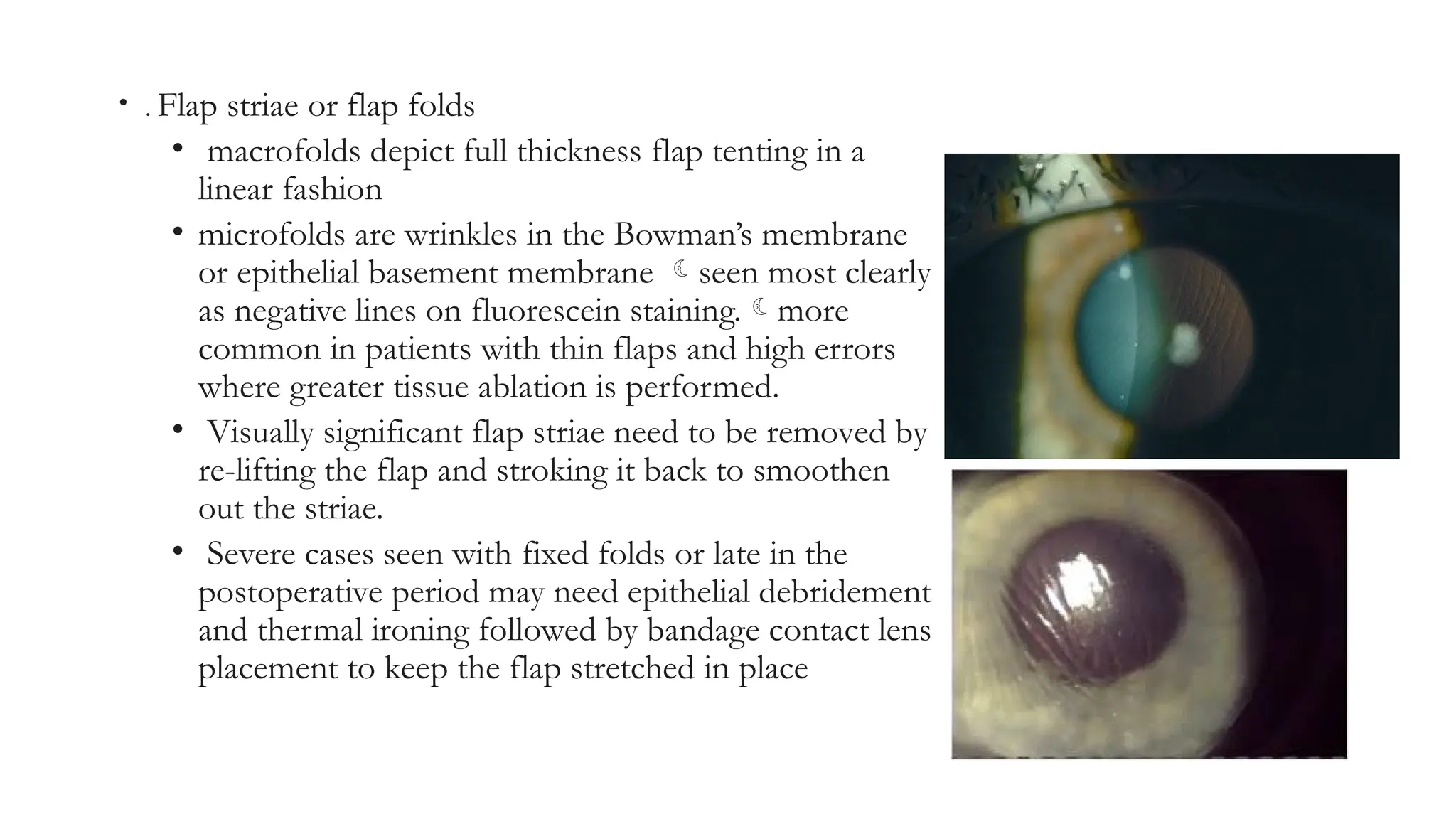 • . Flap striae or flap folds
• macrofolds depict full thickness flap tenting in a
linear fashion
• microfolds are wrinkles in the Bowman’s membrane
or epithelial basement membrane seen most clearly
as negative lines on fluorescein staining.more
common in patients with thin flaps and high errors
where greater tissue ablation is performed.
• Visually significant flap striae need to be removed by
re-lifting the flap and stroking it back to smoothen
out the striae.
• Severe cases seen with fixed folds or late in the
postoperative period may need epithelial debridement
and thermal ironing followed by bandage contact lens
placement to keep the flap stretched in place
 