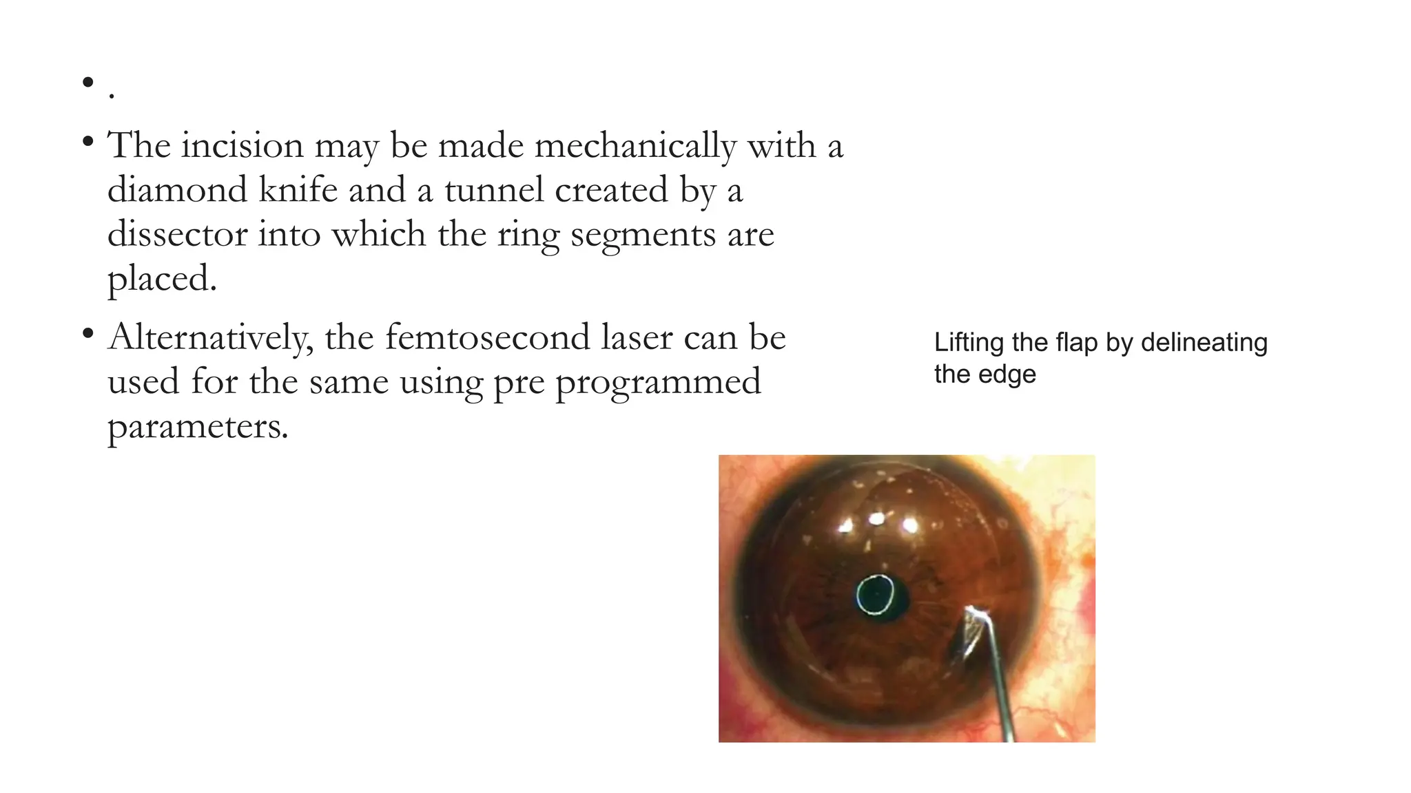 • .
• The incision may be made mechanically with a
diamond knife and a tunnel created by a
dissector into which the ring segments are
placed.
• Alternatively, the femtosecond laser can be
used for the same using pre programmed
parameters.
Lifting the flap by delineating
the edge
 