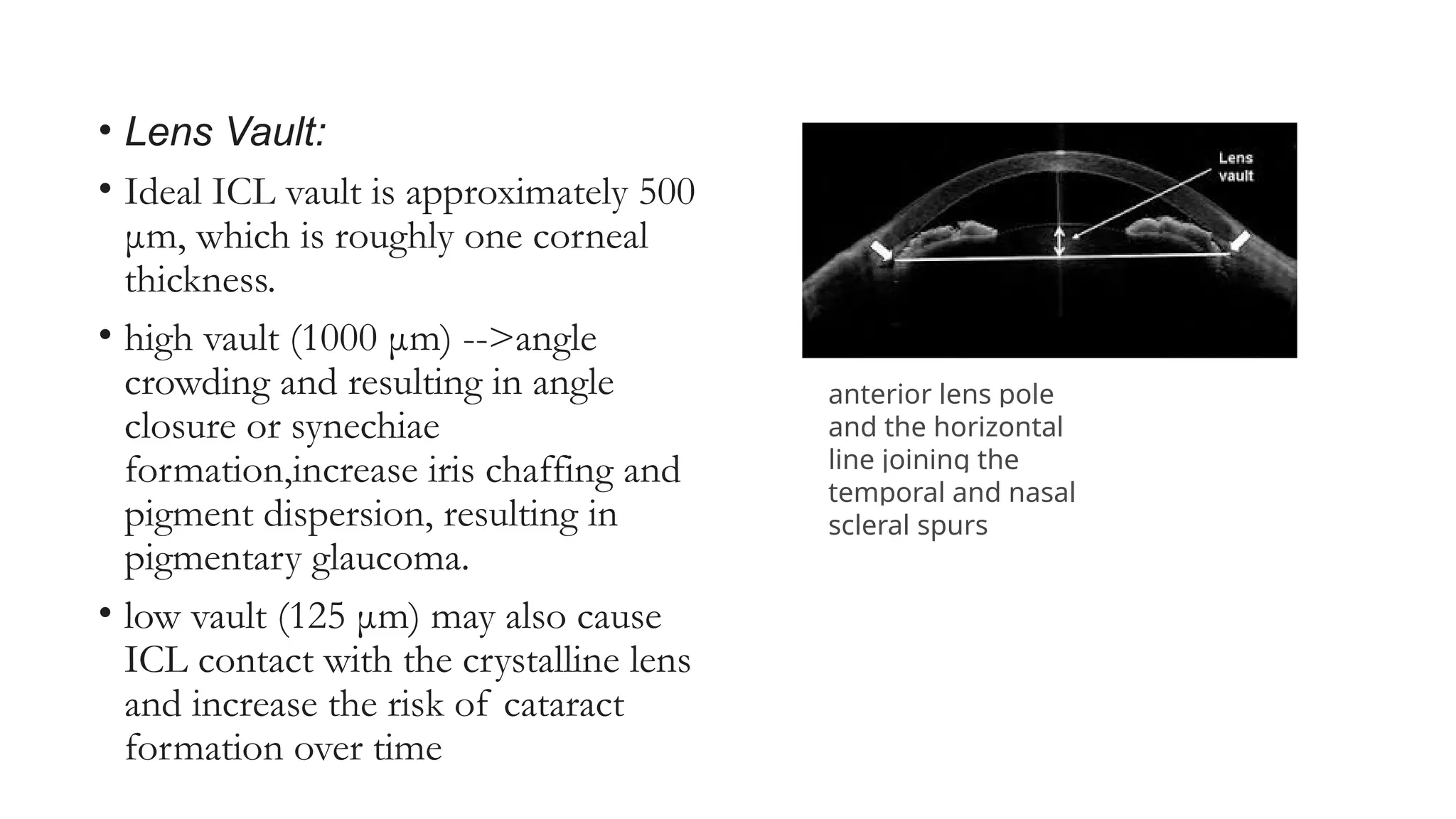 • Lens Vault:
• Ideal ICL vault is approximately 500
μm, which is roughly one corneal
thickness.
• high vault (1000 μm) -->angle
crowding and resulting in angle
closure or synechiae
formation,increase iris chaffing and
pigment dispersion, resulting in
pigmentary glaucoma.
• low vault (125 μm) may also cause
ICL contact with the crystalline lens
and increase the risk of cataract
formation over time
anterior lens pole
and the horizontal
line joining the
temporal and nasal
scleral spurs
 