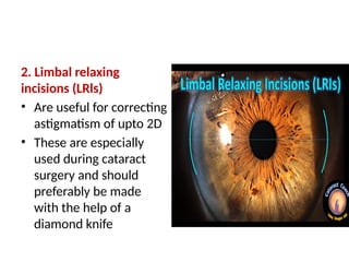 Refractive surgery for post graduates.pptx