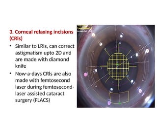 Refractive surgery for post graduates.pptx
