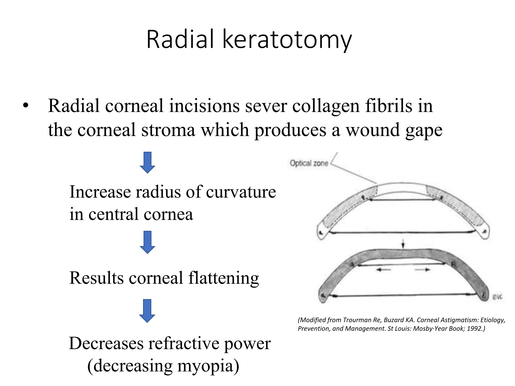 Radial keratotomy
(Modified from Trourman Re, Buzard KA. Corneal Astigmatism: Etiology,
Prevention, and Management. St Louis: Mosby·Year Book; 1992.)
• Radial corneal incisions sever collagen fibrils in
the corneal stroma which produces a wound gape
Decreases refractive power
(decreasing myopia)
Results corneal flattening
Increase radius of curvature
in central cornea
 