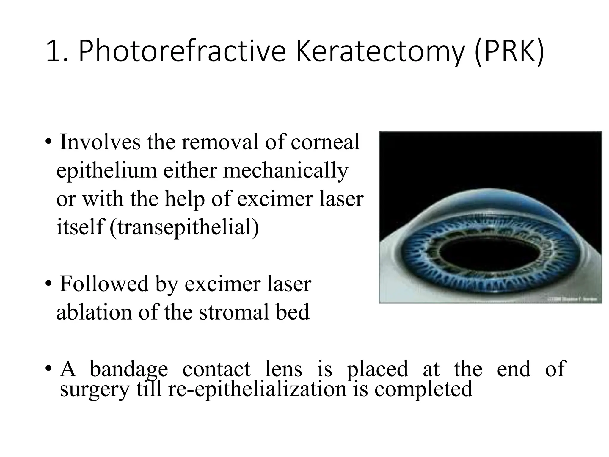 1. Photorefractive Keratectomy (PRK)
• Involves the removal of corneal
epithelium either mechanically
or with the help of excimer laser
itself (transepithelial)
• Followed by excimer laser
ablation of the stromal bed
• A bandage contact lens is placed at the end of
surgery till re-epithelialization is completed
 