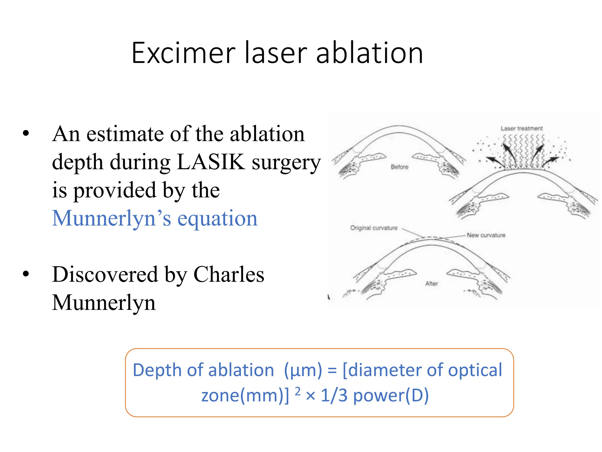 Excimer laser ablation
Depth of ablation (µm) = [diameter of optical
zone(mm)] 2 × 1/3 power(D)
• An estimate of the ablation
depth during LASIK surgery
is provided by the
Munnerlyn’s equation
• Discovered by Charles
Munnerlyn
 