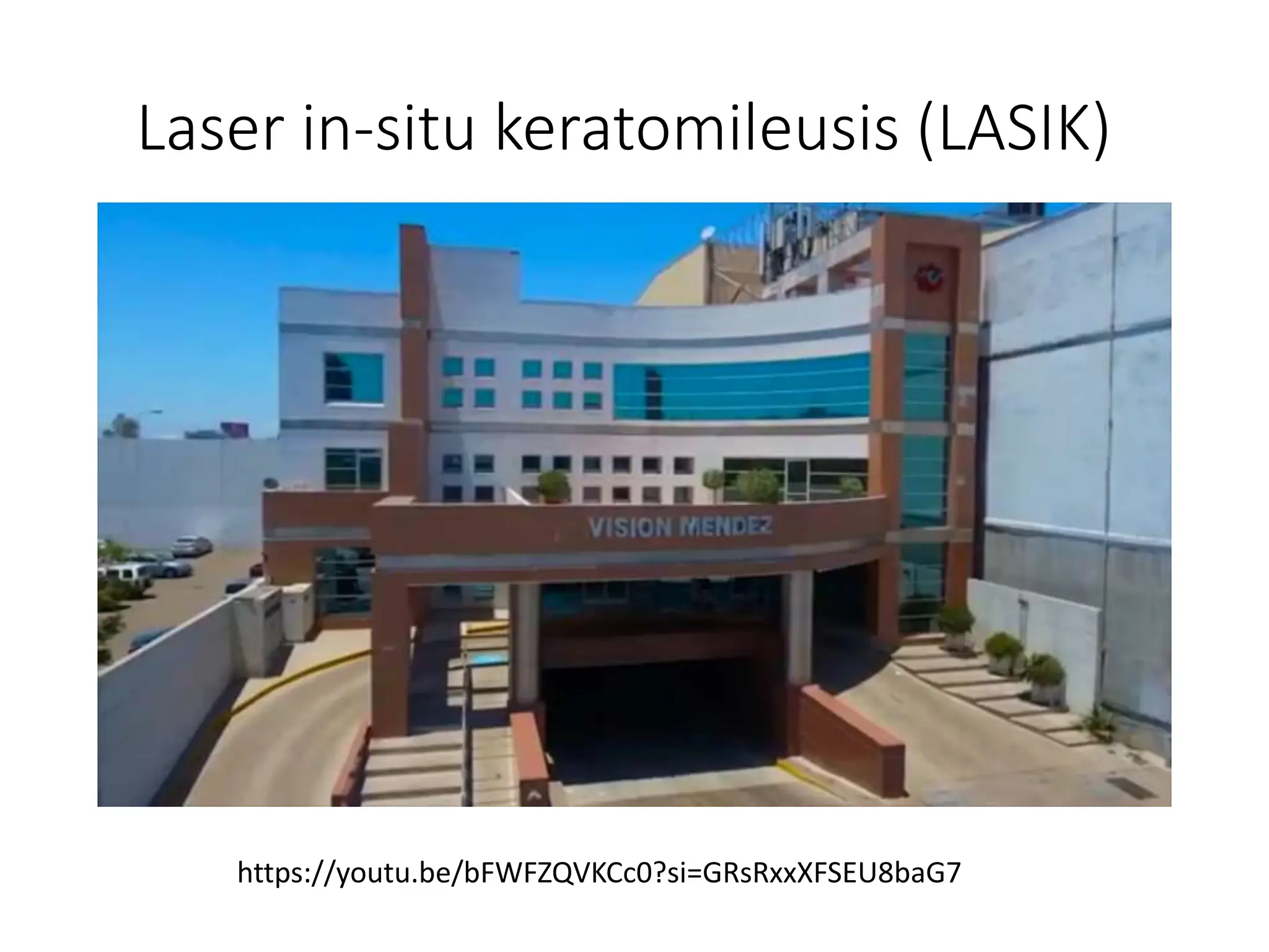 Laser in-situ keratomileusis (LASIK)
https://youtu.be/bFWFZQVKCc0?si=GRsRxxXFSEU8baG7
 