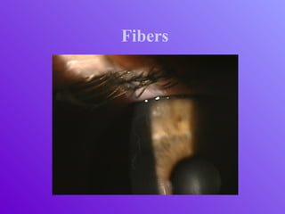 Fibers
 