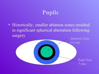 Pupils
• Historically, smaller ablation zones resulted
in significant spherical aberration following
surgery
Ablation Zone
6.0 mm
Pupil Size
7 mm
 