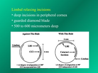 Refractive surgery for GP's | PPT