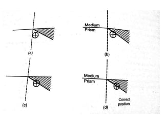 Refractometry | PPTX