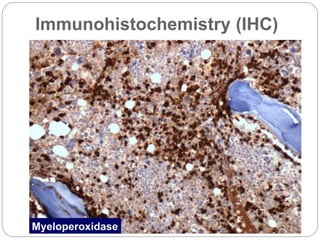 Immunohistochemistry (IHC)
 
