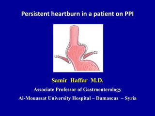 Persistent heartburn in a patient on PPI
Samir Haffar M.D.
Associate Professor of Gastroenterology
Al-Mouassat University Hospital – Damascus – Syria
 