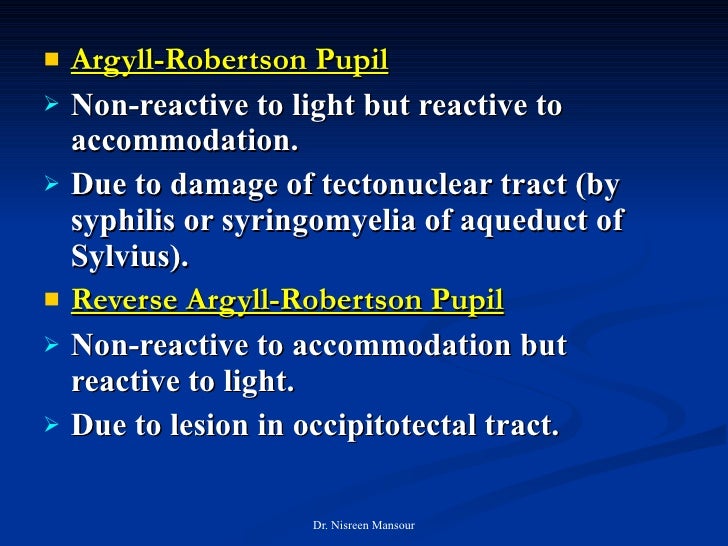 argyll robertson pupil video argyll robertson pupil video