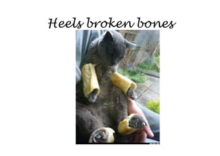 Heels broken bones
 