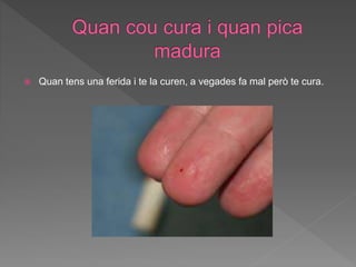  Quan tens una ferida i te la curen, a vegades fa mal però te cura.
 