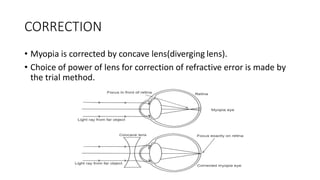REFRATIVE ERROR BASICS FOR MEDICAL AND NURSING STUDENTS | PDF | Eye and ...