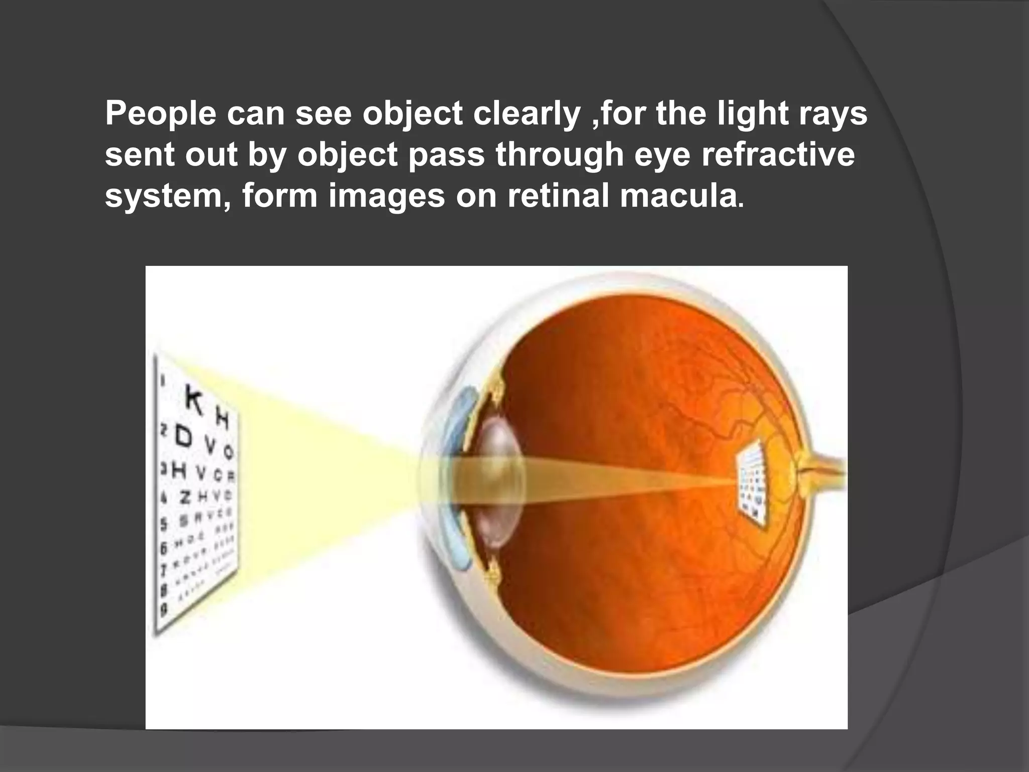 People can see object clearly ,for the light rays
sent out by object pass through eye refractive
system, form images on retinal macula.
 
