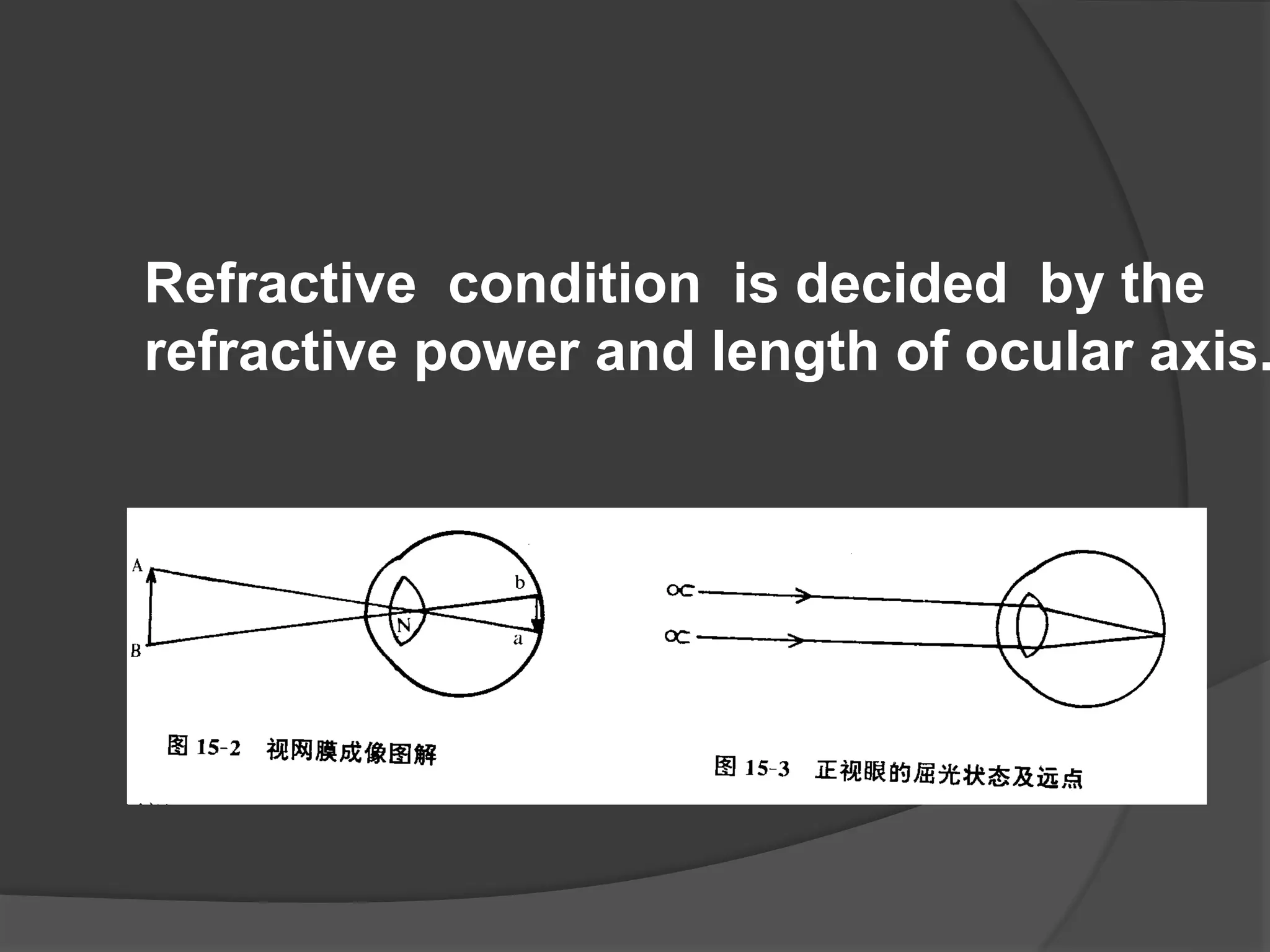 Refractive condition is decided by the
refractive power and length of ocular axis.
 