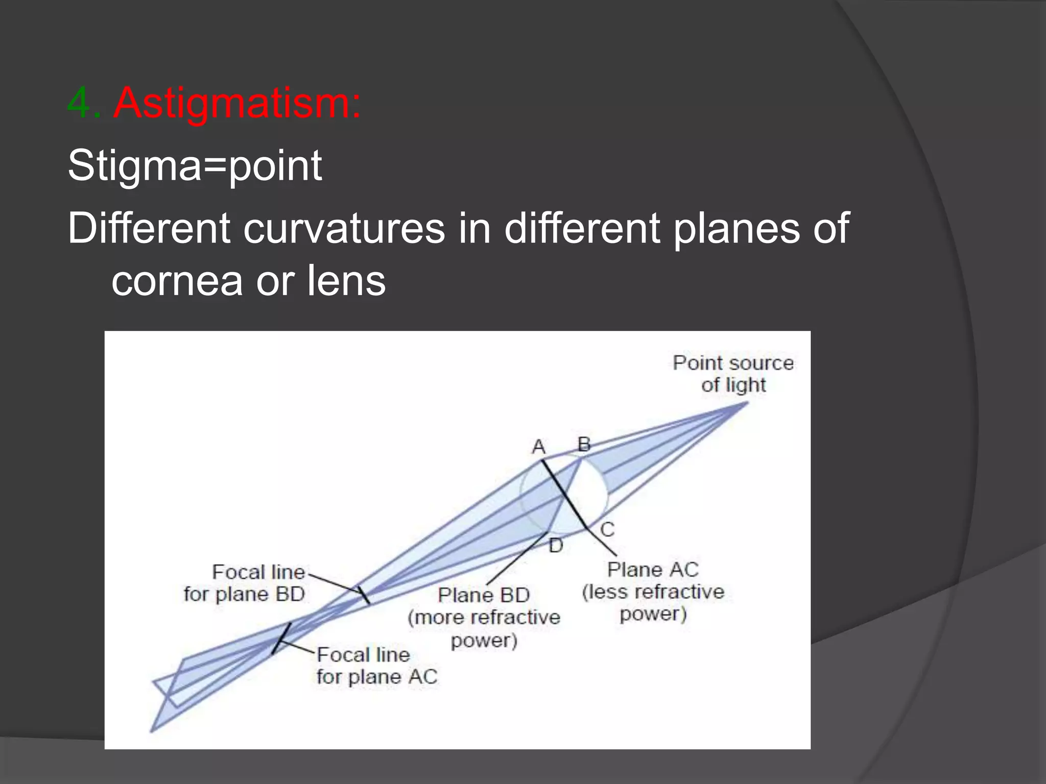 4. Astigmatism:
Stigma=point
Different curvatures in different planes of
cornea or lens
 