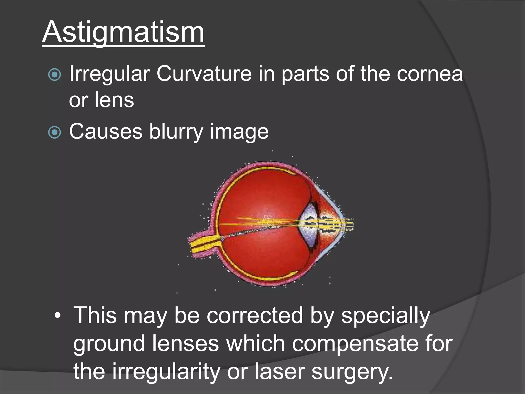 Astigmatism
 Irregular Curvature in parts of the cornea
or lens
 Causes blurry image
• This may be corrected by specially
ground lenses which compensate for
the irregularity or laser surgery.
 