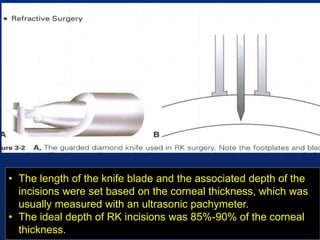 Procedure
• The length of the knife blade and the associated depth of the
incisions were set based on the corneal thickness, which was
usually measured with an ultrasonic pachymeter.
• The ideal depth of RK incisions was 85%-90% of the corneal
thickness.
 