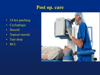 Post op. care
• 24 hrs patching
• Cycloplegic
• Steroid
• Topical steroid
• Tear drop
• BCL
 