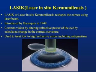 LASIK(Laser in situ Keratomileusis )
• LASIK or Laser in situ Keratomileusis reshapes the cornea using
laser beam.
• Introduced by Barraquer in 1949.
• Corrects vision by altering refractive power of the eye by
calculated change in the corneal curvature.
• Used to treat low to high refractive errors including astigmatism.
 