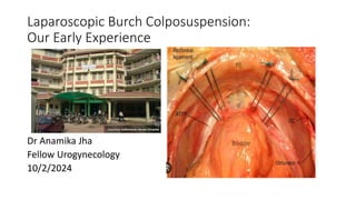 Laparoscopic Burch Colposuspension:
Our Early Experience
Dr Anamika Jha
Fellow Urogynecology
10/2/2024
 