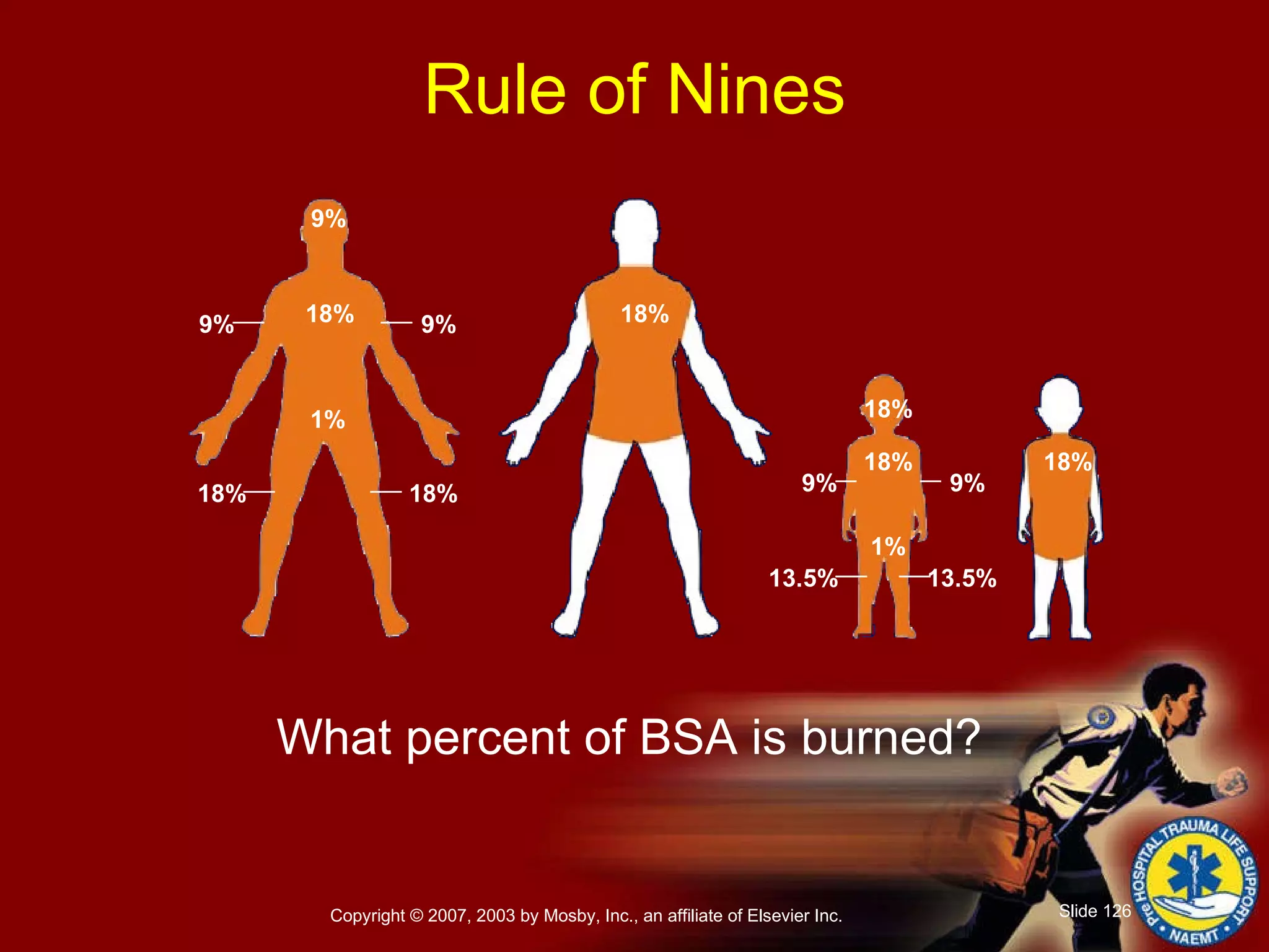 Rule of Nines What percent of BSA is burned? 9% 18% 9% 9% 18% 18% 18% 1% 18% 18% 9% 9% 18% 1% 13.5% 13.5% 