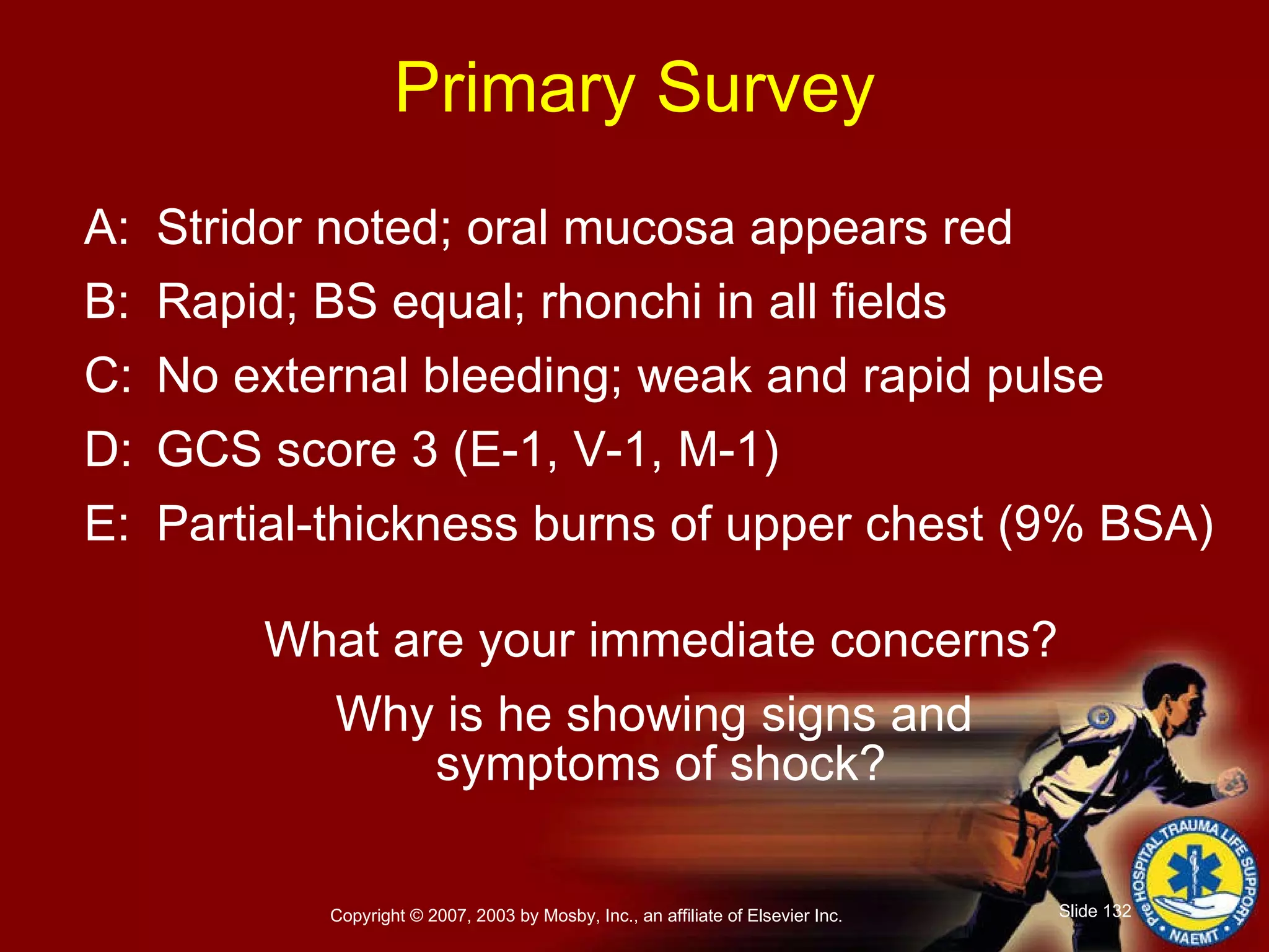 Primary Survey A: Stridor noted; oral mucosa appears red B: Rapid; BS equal; rhonchi in all fields C: No external bleeding; weak and rapid pulse D: GCS score 3 (E-1, V-1, M-1) E: Partial-thickness burns of upper chest (9% BSA) What are your immediate concerns? Why is he showing signs and  symptoms of shock? 