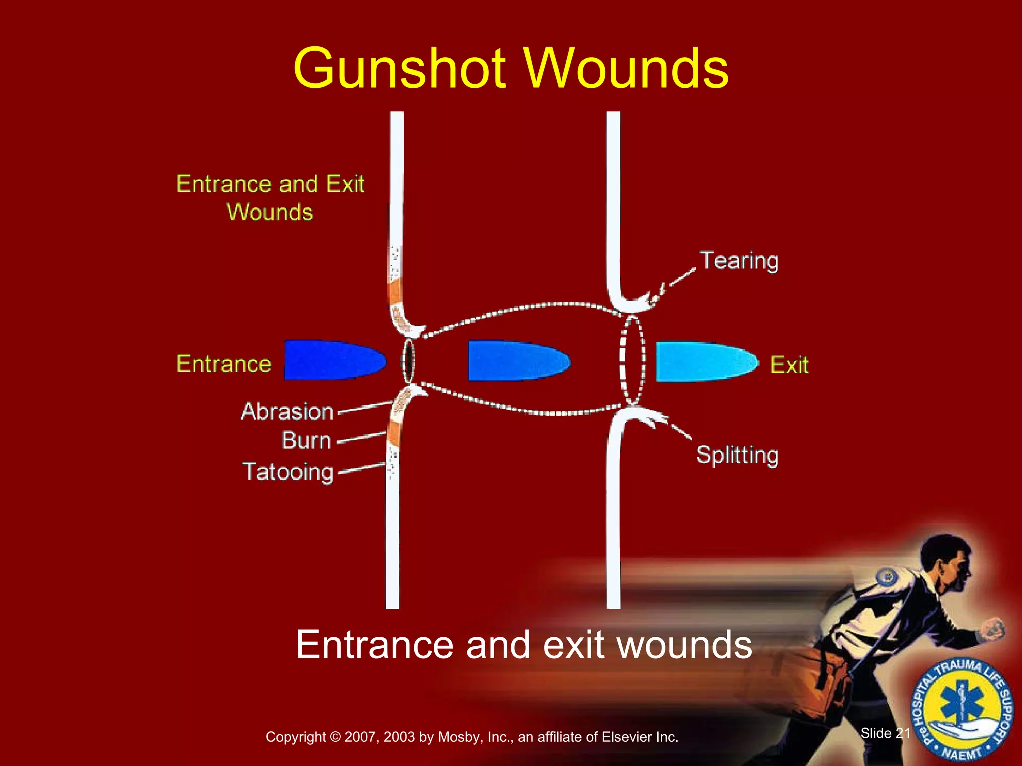 Entrance and exit wounds Gunshot Wounds 