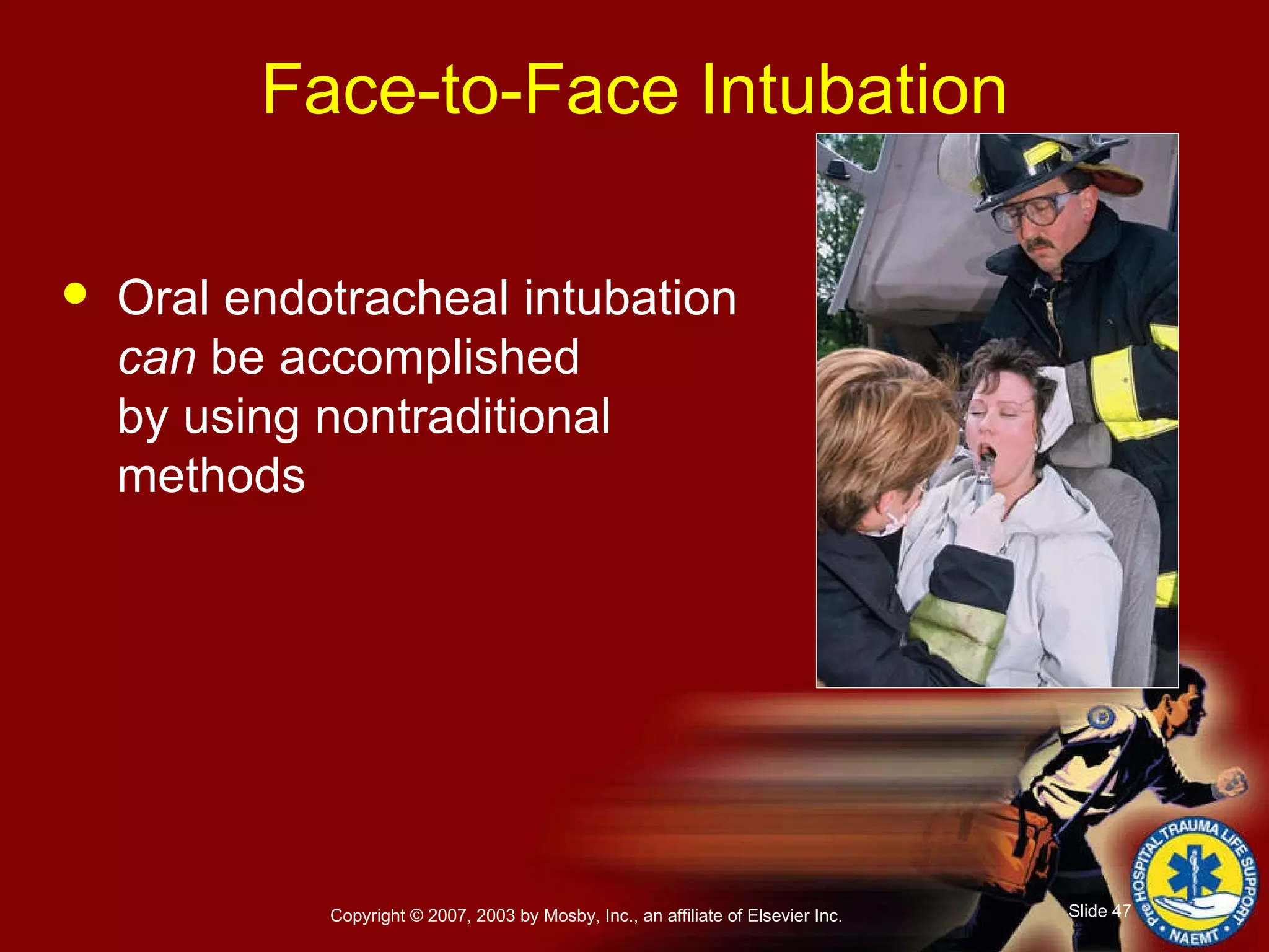 Face-to-Face Intubation Oral endotracheal intubation  can  be accomplished  by using nontraditional methods 