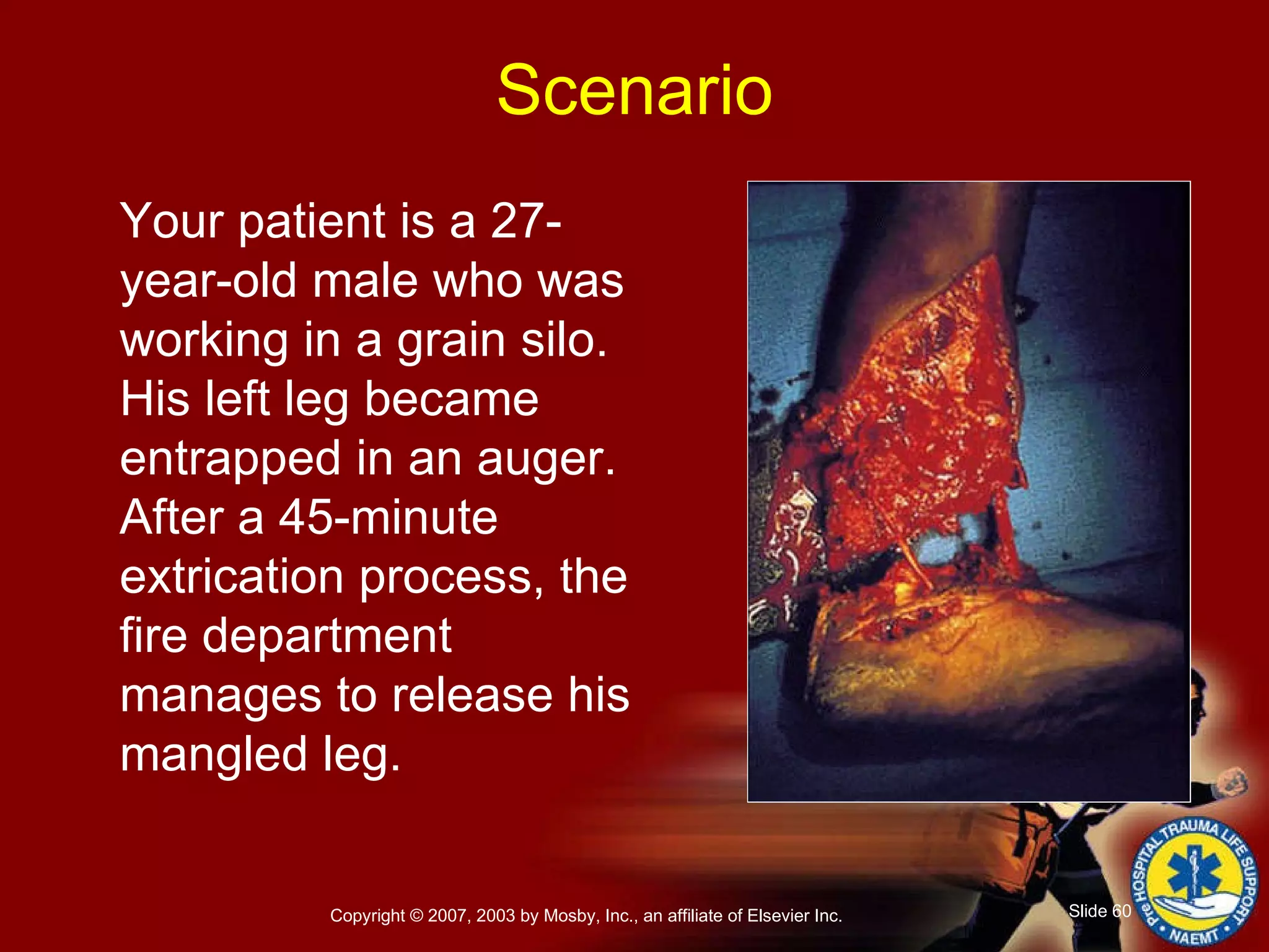 Your patient is a 27-year-old male who was working in a grain silo. His left leg became entrapped in an auger. After a 45-minute extrication process, the fire department manages to release his mangled leg.  Scenario 