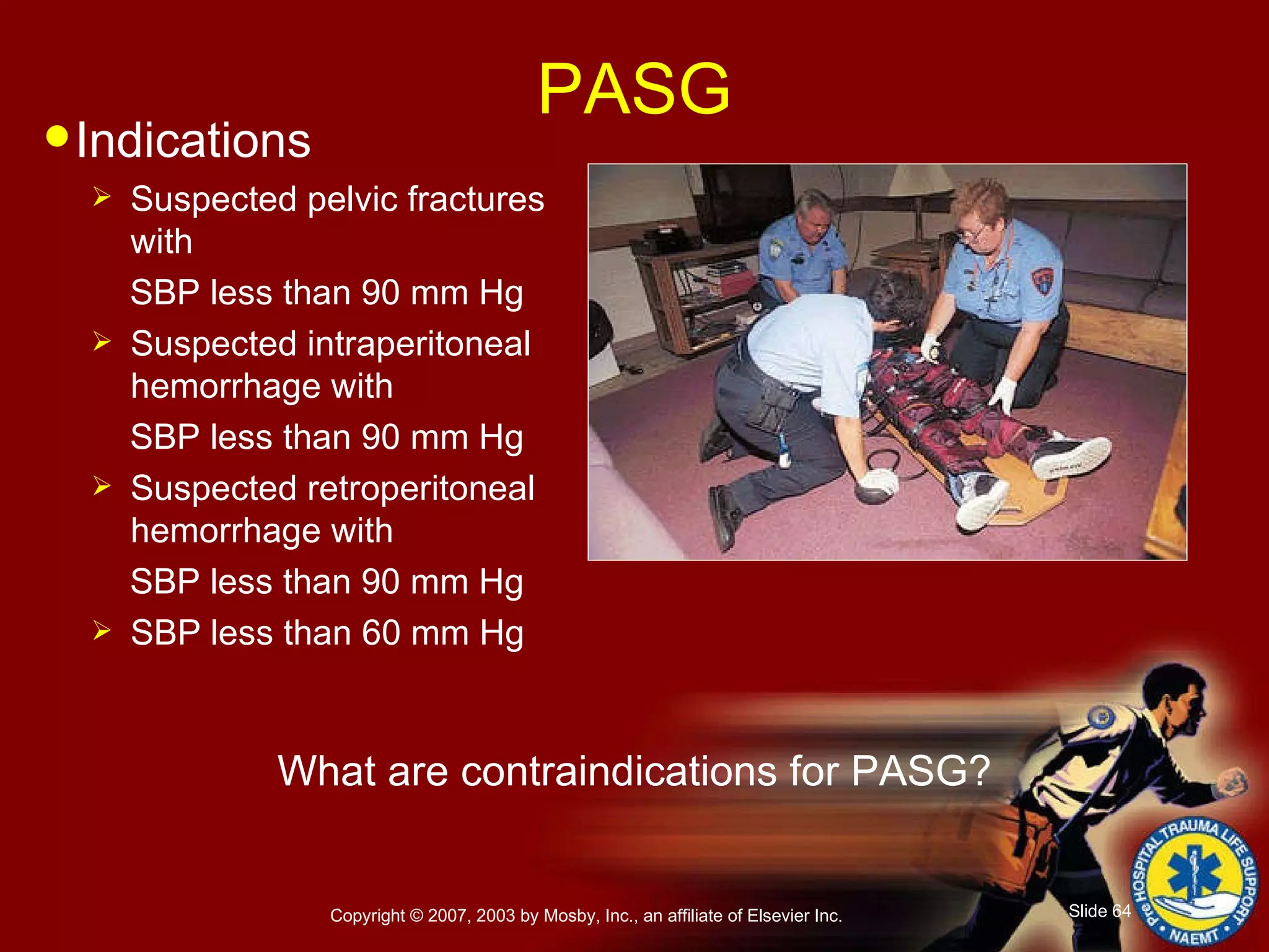 PASG Indications Suspected pelvic fractures with  SBP less than 90 mm Hg Suspected intraperitoneal hemorrhage with  SBP less than 90 mm Hg Suspected retroperitoneal hemorrhage with  SBP less than 90 mm Hg SBP less than 60 mm Hg What are contraindications for PASG? 