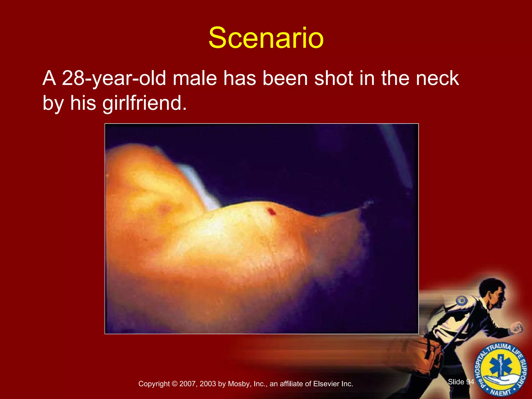 A 28-year-old male has been shot in the neck by his girlfriend.  Scenario 