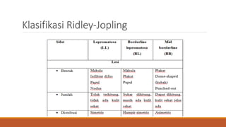 Klasifikasi Ridley-Jopling
 