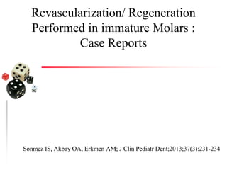 Revascularization/ Regeneration
Performed in immature Molars :
Case Reports
Sonmez IS, Akbay OA, Erkmen AM; J Clin Pediatr Dent;2013;37(3):231-234
 