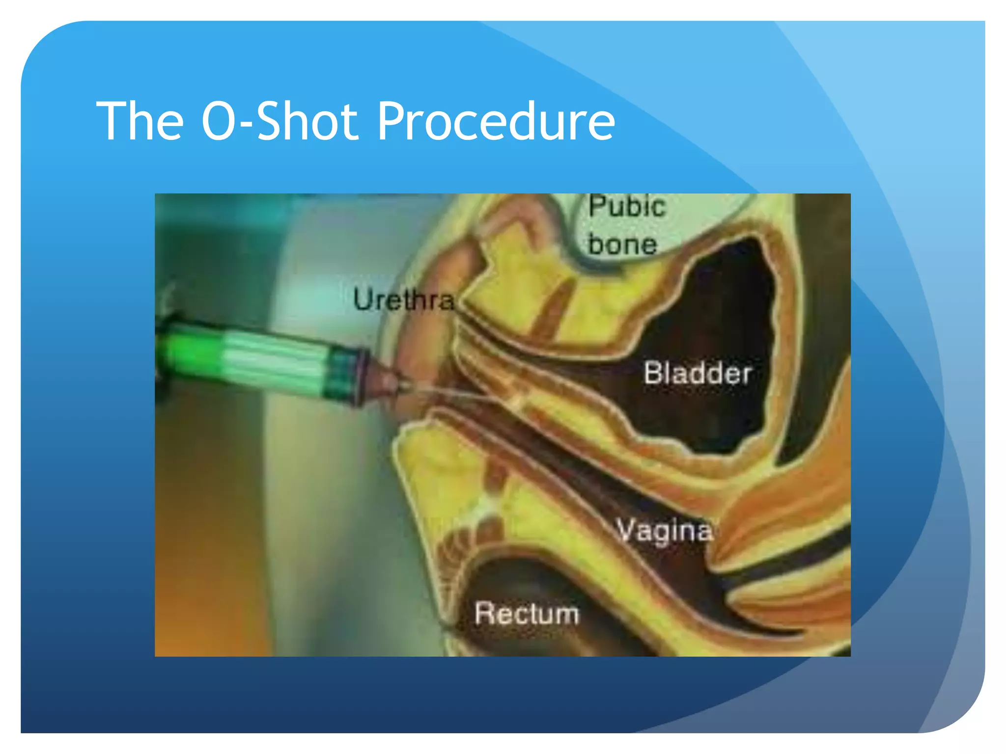 Regenerative and aesthetic Medicine | PPTX