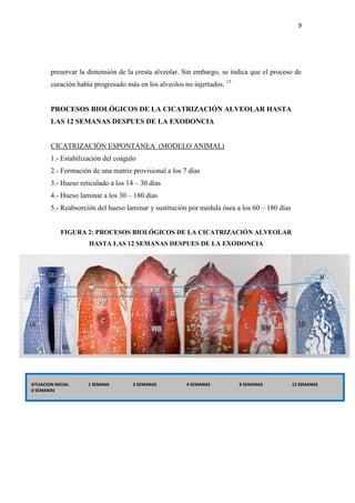 9
preservar la dimensión de la cresta alveolar. Sin embargo, se indica que el proceso de
curación había progresado más en los alveolos no injertados. 15
PROCESOS BIOLÓGICOS DE LA CICATRIZACIÓN ALVEOLAR HASTA
LAS 12 SEMANAS DESPUES DE LA EXODONCIA
CICATRIZACIÓN ESPONTÁNEA (MODELO ANIMAL)
1.- Estabilización del coágulo
2.- Formación de una matriz provisional a los 7 días
3.- Hueso reticulado a los 14 – 30 días
4.- Hueso laminar a los 30 – 180 días
5.- Reabsorción del hueso laminar y sustitución por medula ósea a los 60 – 180 días
FIGURA 2: PROCESOS BIOLÓGICOS DE LA CICATRIZACIÓN ALVEOLAR
HASTA LAS 12 SEMANAS DESPUES DE LA EXODONCIA
SITUACION INICIAL 1 SEMANA 2 SEMANAS 4 SEMANAS 8 SEMANAS 12 SEMANAS
0 SEMANAS
 